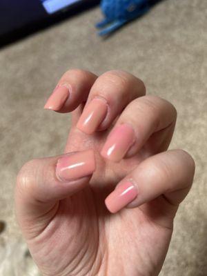 Acrylic nails that are supposed to be one color. Cuts all around my cuticles