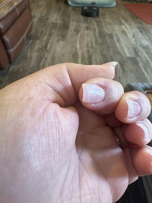 Cut up cuticle, stopped bleeding.