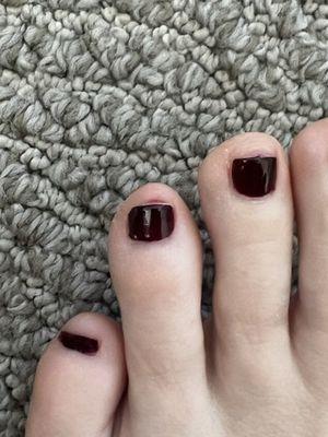 Bleeding and exposed nail beds