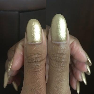 These are not the only fingers that are significantly and noticeably different in length