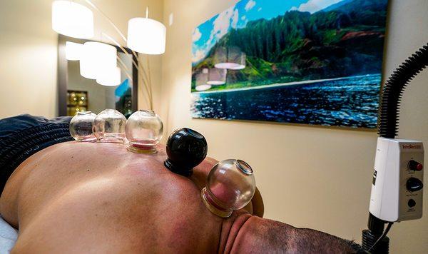 Fire Cupping Myofascial Release for professional athletes