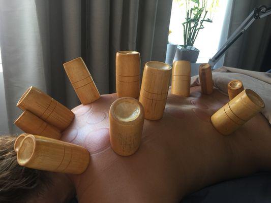 Cupping therapy.