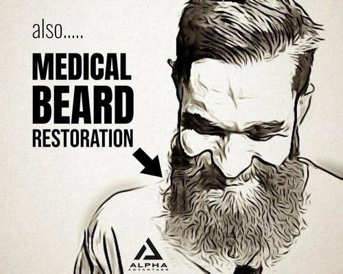 Medical Beard Restoration with Stem Cells & Exosomes.