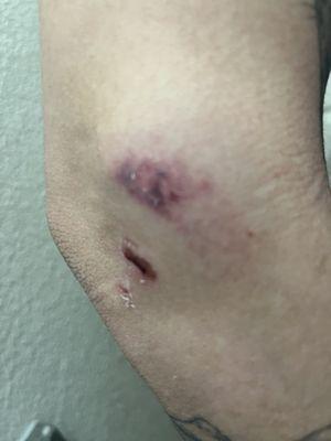 Injury from kid breaking door in