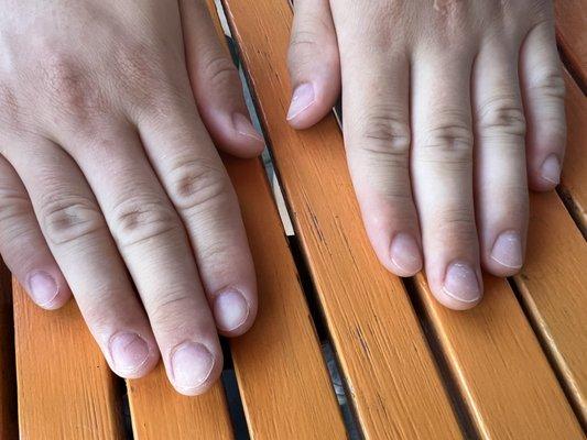 His nails look super chalky and uneven