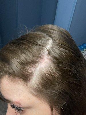 Another bald spot