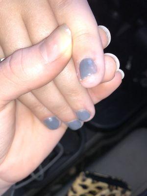 Cut and messed up nail