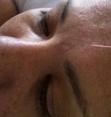 NEW Life Acupuncture