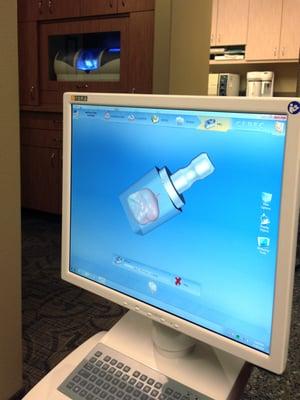 One-visit, same-day  "cerec" crowns