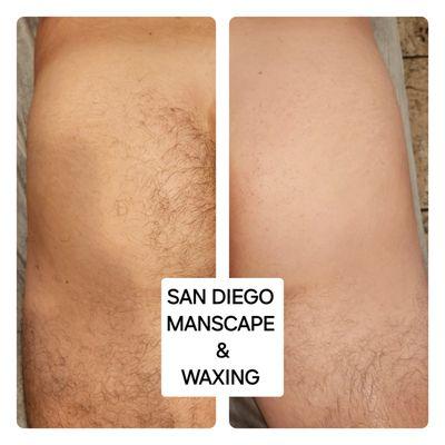 But wax hair removal  Brazilian  wax for men