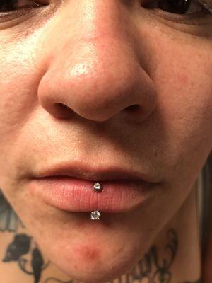 Angel Kiss (vertical lip) piercing done with front facing diamond jewelry.