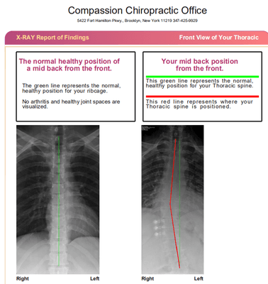 Thoracic x-ray