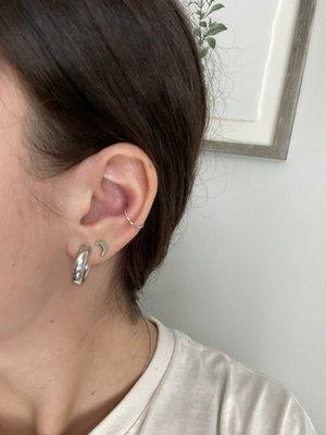 Conch piercing (around a week after)