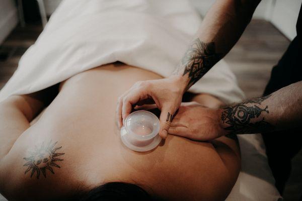 A client receiving cupping during a massage session.