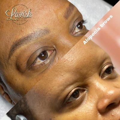 Enhancing her alopecia brow with hairstrokes