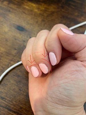 Horrible nail