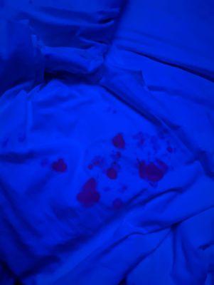 Blood stain linen on our hotel room bed