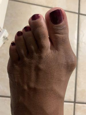 Zoom in to my 3rd toenail, the polish is uneven.  I noticed it when I got home. The skill and technique is missing at this salon.