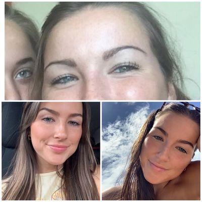 Rehabbed brows before and after