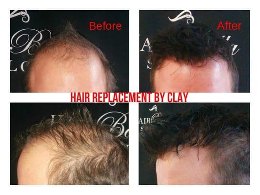 Hair relpacement by Clay Daniel.  Custom designs to fit clients needs. Free consultations!