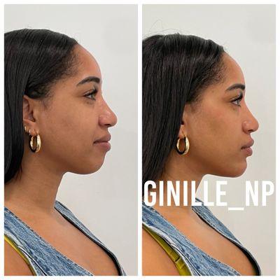 Ginille Beauty Aesthetics