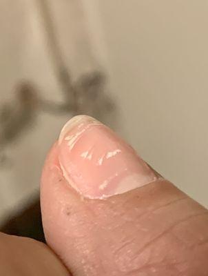 Gouges and dents in my nails