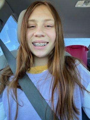 Illyana V. Happy with braces done by Edwin.