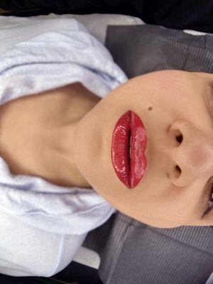 Full Lips Technique