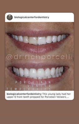 Before and after by Dr. Richard Porcelli