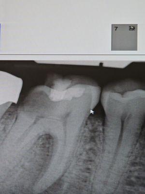 Oof a reminder of why we care for our teeth