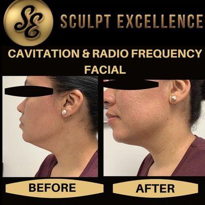 Sculpt Excellence