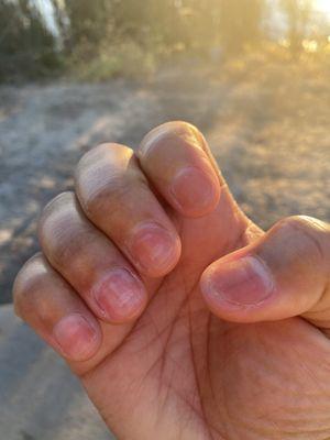 Nails are brittle, cracked and stained after using regular nail polish on freshly removed gel polish.