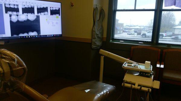 The chair, the view, and the monitor with x-rays.