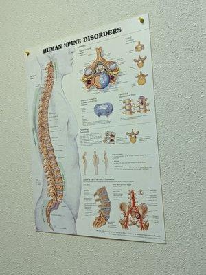 Back and spine poster