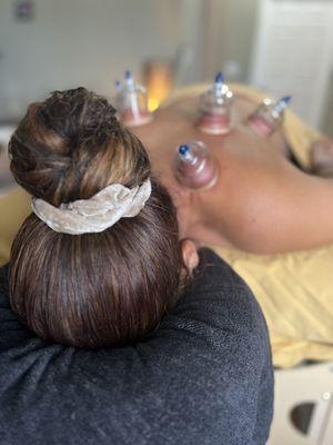 Cupping Massage