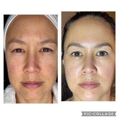 Total skin repair