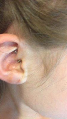 Her right side Daith piercing.