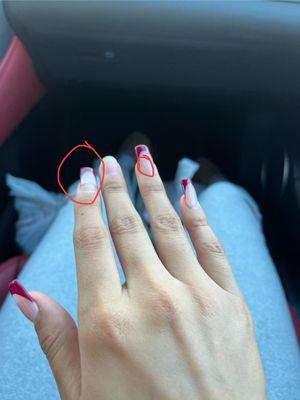 I circled where the nail started to come off and the cracks on the other nails