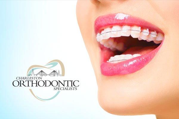 Best Orthodontist in Charleston Charleston Family Orthodontics