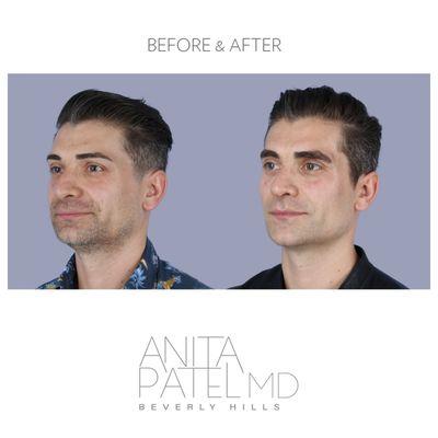 Liquid Makeover by Anita Patel, MD