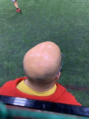 This is the top of his head.