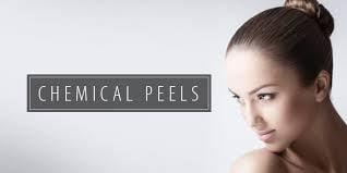 Chemical Peels for only $110