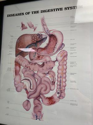 What everyone needs to know - diseases of the digestive system. Ugh.