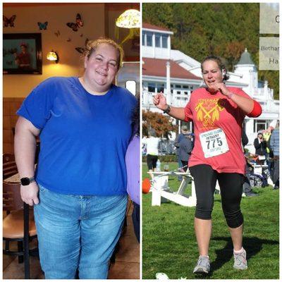 Congratulations to Bethany on successful completion of Triathlon 2 years after Gastric Sleeve at Arch Bariatrics, St Louis.