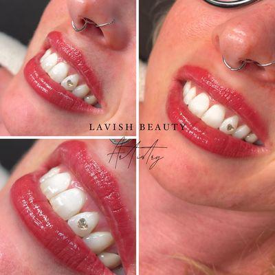 Tooth gems offered here at Lavish Beauty