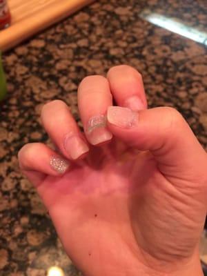 The terrible job they did on my nails!