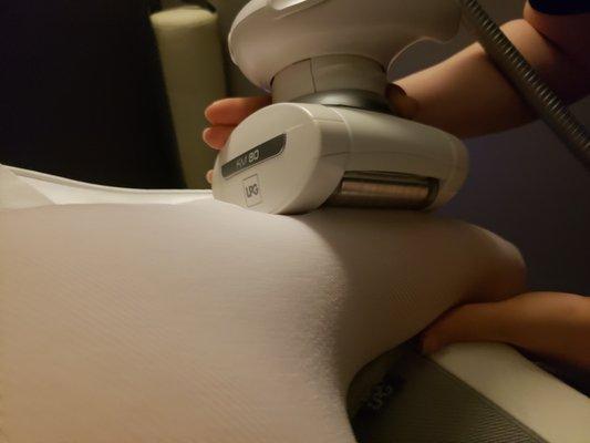 Endermologie saggy arms skin treatment