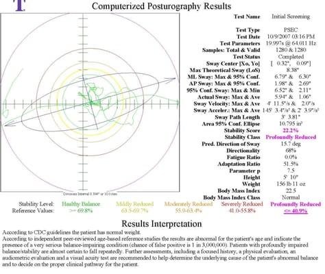 Computerized Posturography is a superior diagnostic tool. Our CAPS unit allows us to assess risk of fall and to assess balanc...