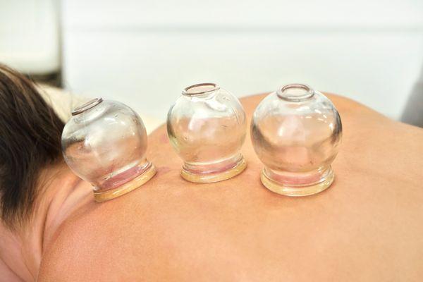 Cupping helps moves stagnant Qi and blood, as well as leaving you feeling relaxed. Cupping services offered for the body or the face.