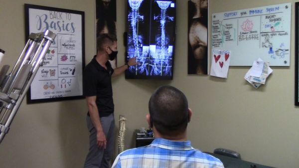 Reviewing before and after X-Rays with patient.